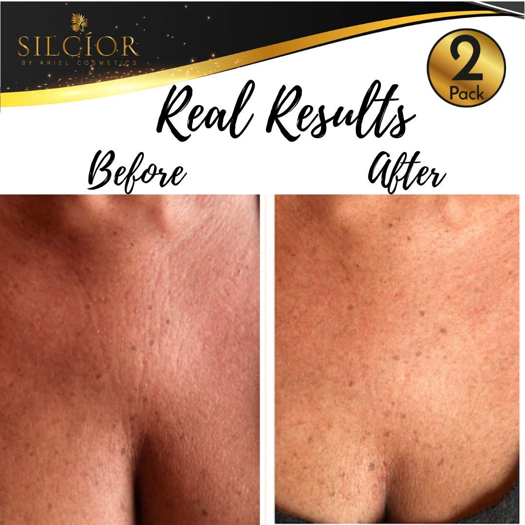 SILCÍOR pad applied on décolleté demonstrating overnight smoothing