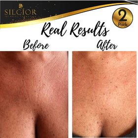 SILCÍOR pad applied on décolleté demonstrating overnight smoothing