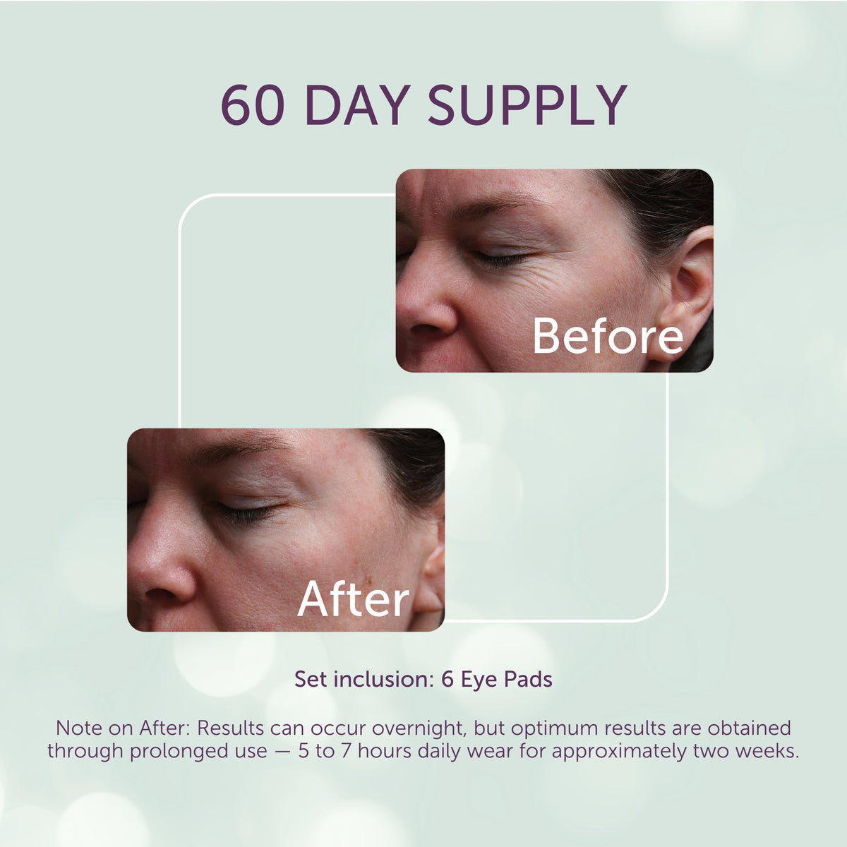 Silc Skin pad applied under eye demonstrating comfortable overnight wear