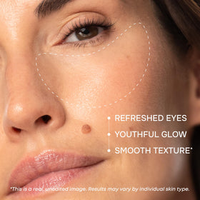 SimplyVital hydrogel close-up texture demonstrating cooling, adherent comfort