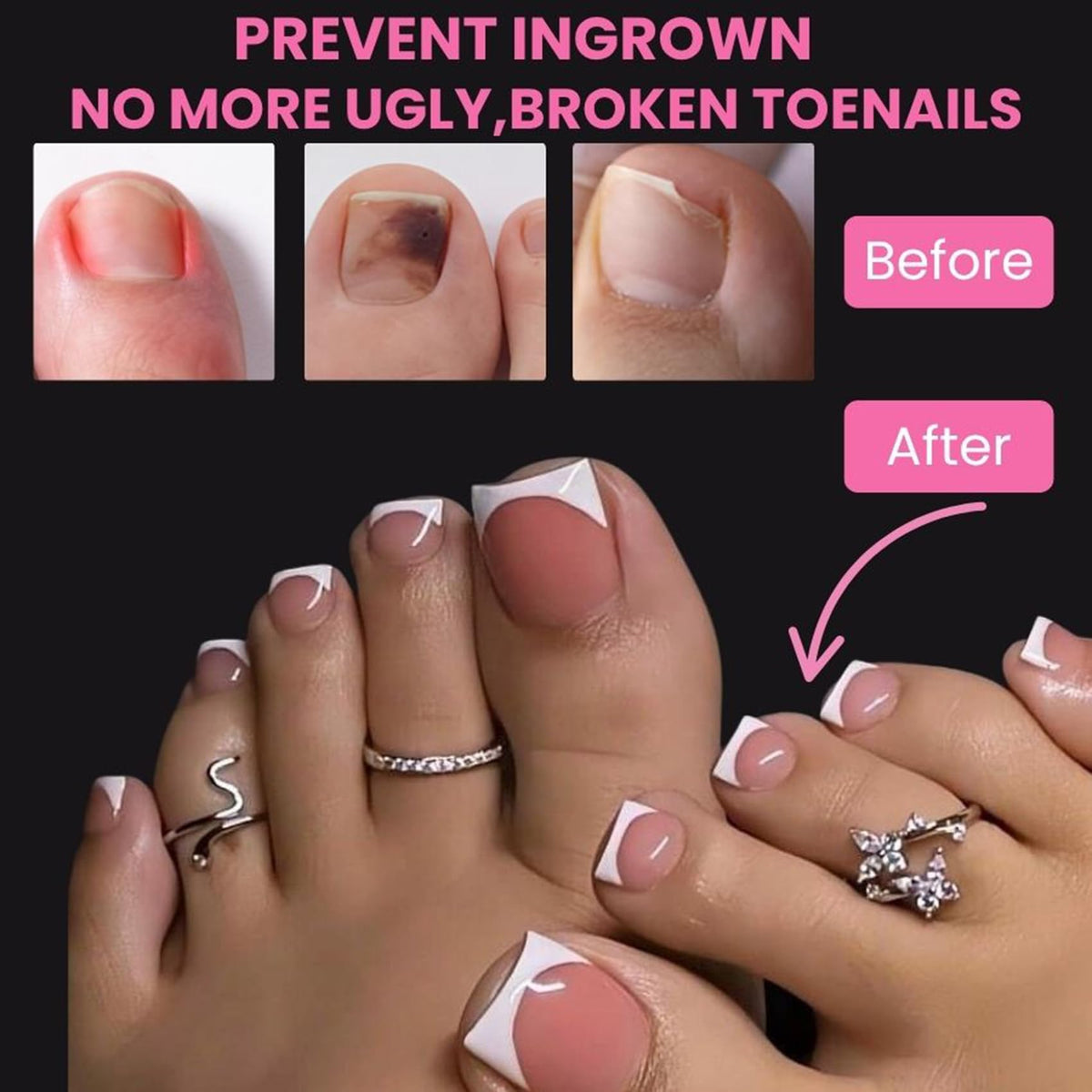 SINOKAME big toe demo on foot showing wider long square fit comfort