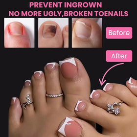 SINOKAME big toe demo on foot showing wider long square fit comfort