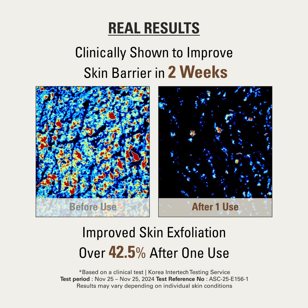 SIOT elbow spot treatment before and after, shows smoothing and improved texture