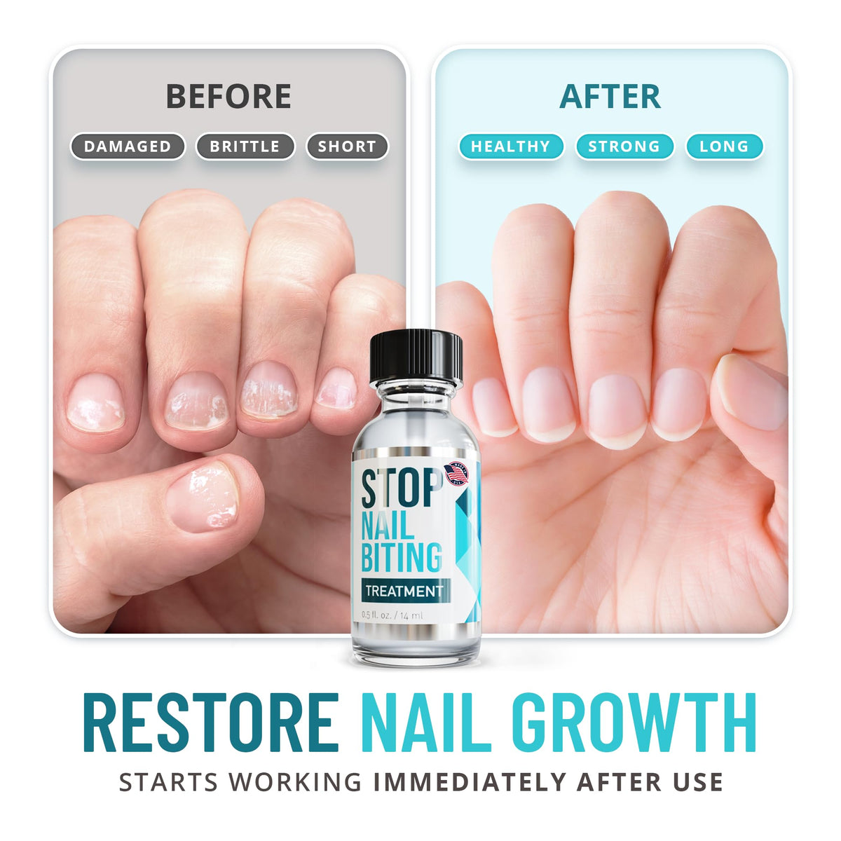 SISQUOC HEALTHCARE clear polish on nail close-up prevents biting and looks natural