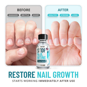 SISQUOC HEALTHCARE clear polish on nail close-up prevents biting and looks natural