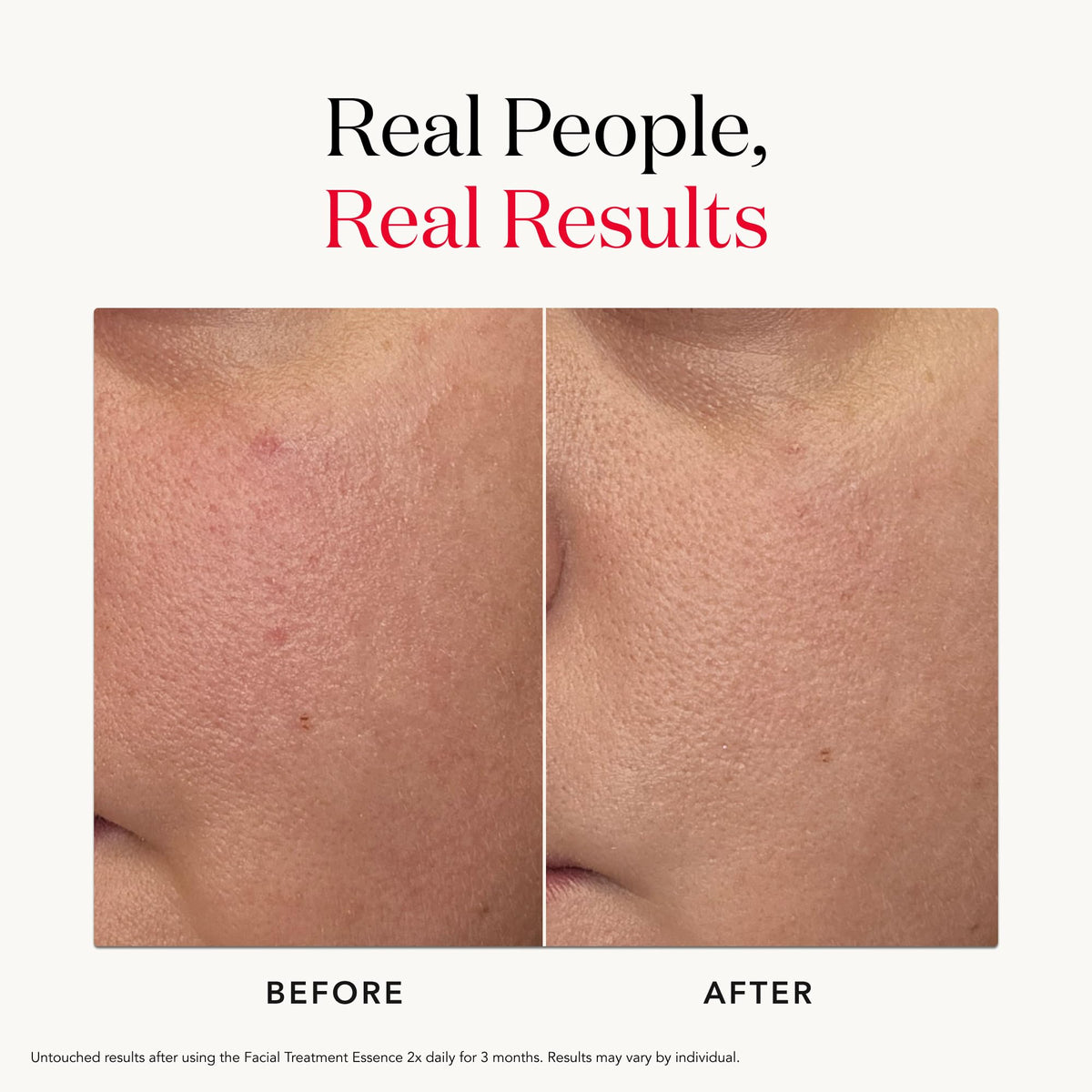 visual arrangement of PITERA™ concept ingredients with SK-II for transparency