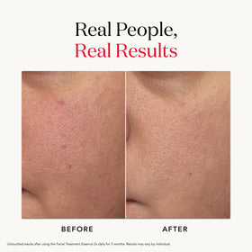 visual arrangement of PITERA™ concept ingredients with SK-II for transparency
