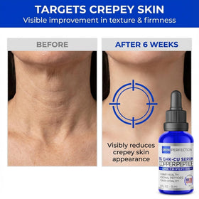 Skin Perfection serum texture close-up highlighting lightweight hydrating feel and absorbency