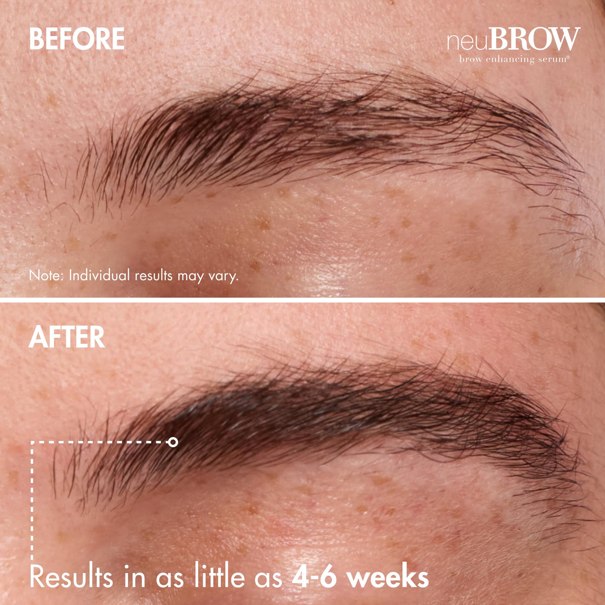 Skin Research Laboratories neuBROW being applied to eyebrow showing targeted control