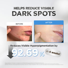 SKIN1004 ampoule dispensing a drop to show easy controlled application