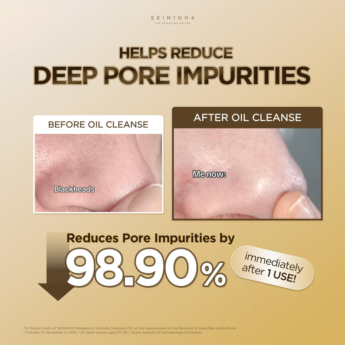 SKIN1004 cleansing oil being massaged on face to dissolve makeup