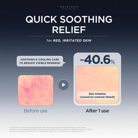 SKIN1004 in-hand scale photo showing the 50ml size and portability benefit