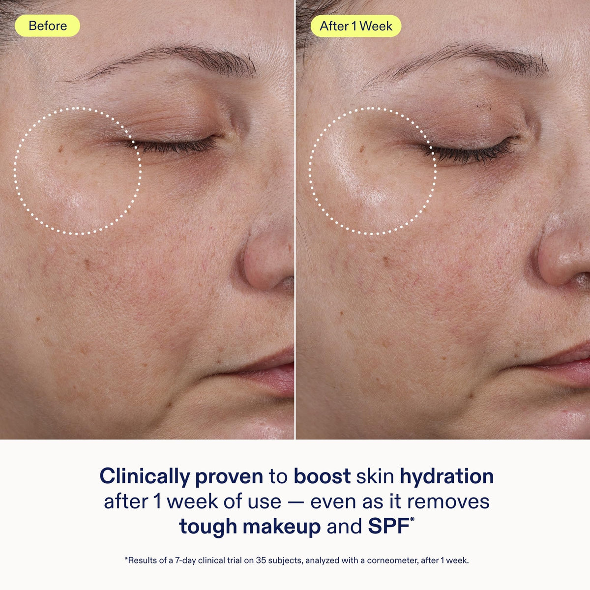Clean skin after using Skinfix cleanser removing SPF and light makeup effectively