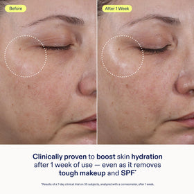 Clean skin after using Skinfix cleanser removing SPF and light makeup effectively
