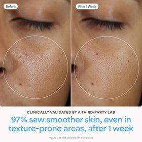 Skinfix cream dispensed on finger demonstrating easy pump application and layering