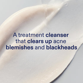 Skinfix label close-up highlighting active acids and gentle formula