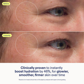 Skinfix cream on fingertip demonstrating smooth spreadability and nourishment