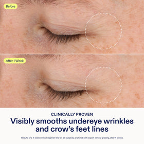 Skinfix pump dispensing cream, demonstrating controlled application benefit