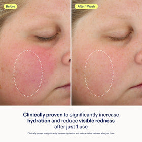 Skinfix rich foam lather demonstrating gentle cleansing benefit