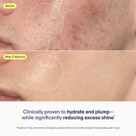 Skinfix gel cream dispensed on fingertip demonstrating easy application and spreadability