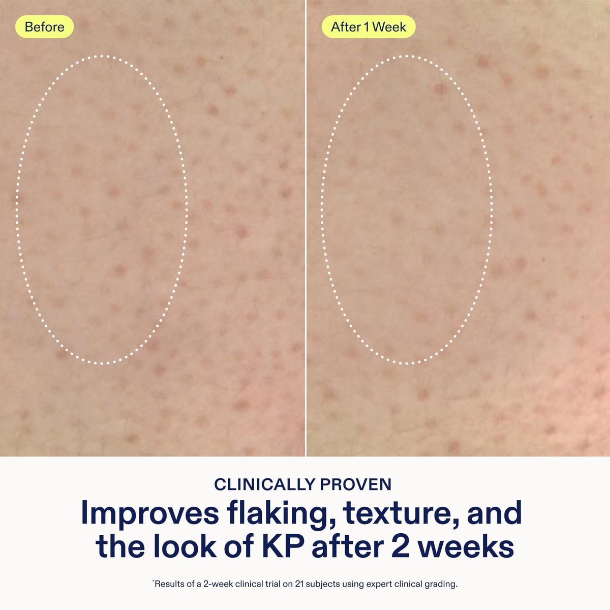 Skinfix ingredient label highlighting B-L3™ Complex and acids, support for smoother skin