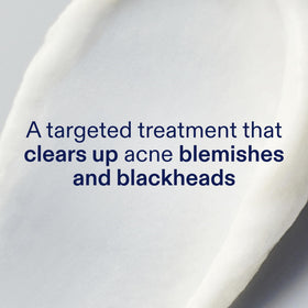 Skinfix label close-up highlighting ingredient strengths for targeted clarity