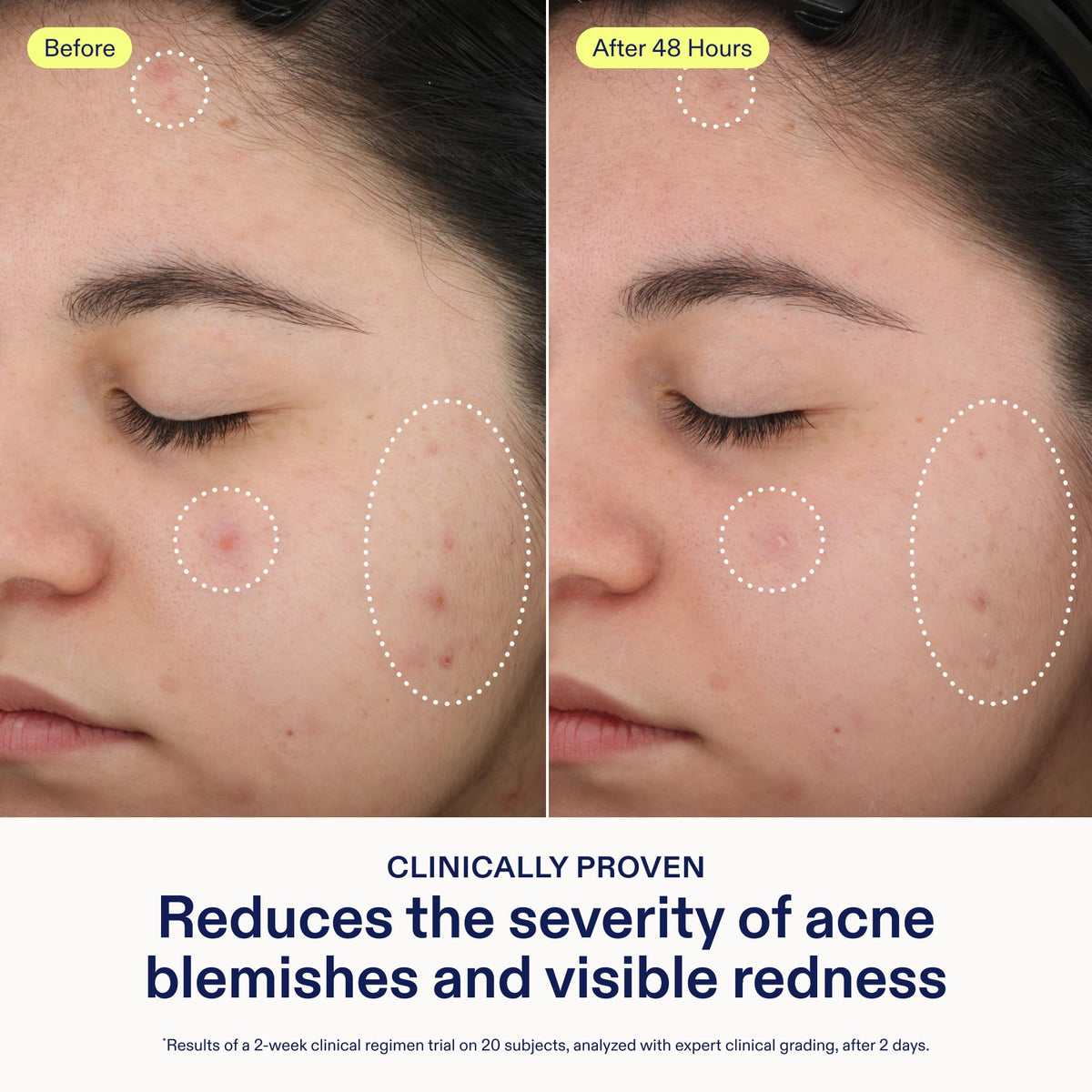 Skinfix serum texture on dropper showing lightweight absorption benefit