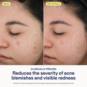 Skinfix serum texture on dropper showing lightweight absorption benefit
