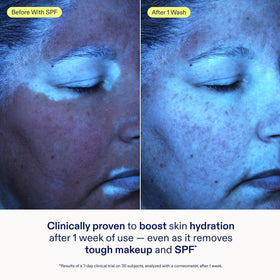 Skinfix gel texture close-up showing smooth hydrating formula