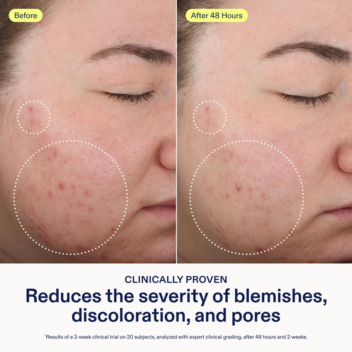 Skinfix cleanser lather texture demonstrating effective exfoliation