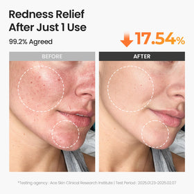 SKINFOOD 1957 pad with visible toner drop highlighting hydrating formula