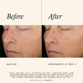 SkinMedica open tub with stacked pads illustrating ready-to-use convenience