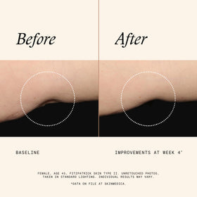 SkinMedica applying lotion to arms to improve tone and hydration appearance
