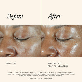 SkinMedica HA5 ingredients label emphasizing HA forms, vegan collagen and botanical tech
