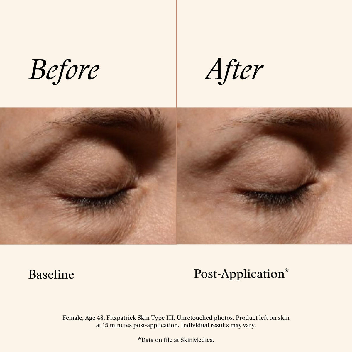 SkinMedica cream being gently tapped under-eye showing easy application and smoothing