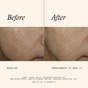 SkinMedica ingredients panel on label, transparent formulation benefit