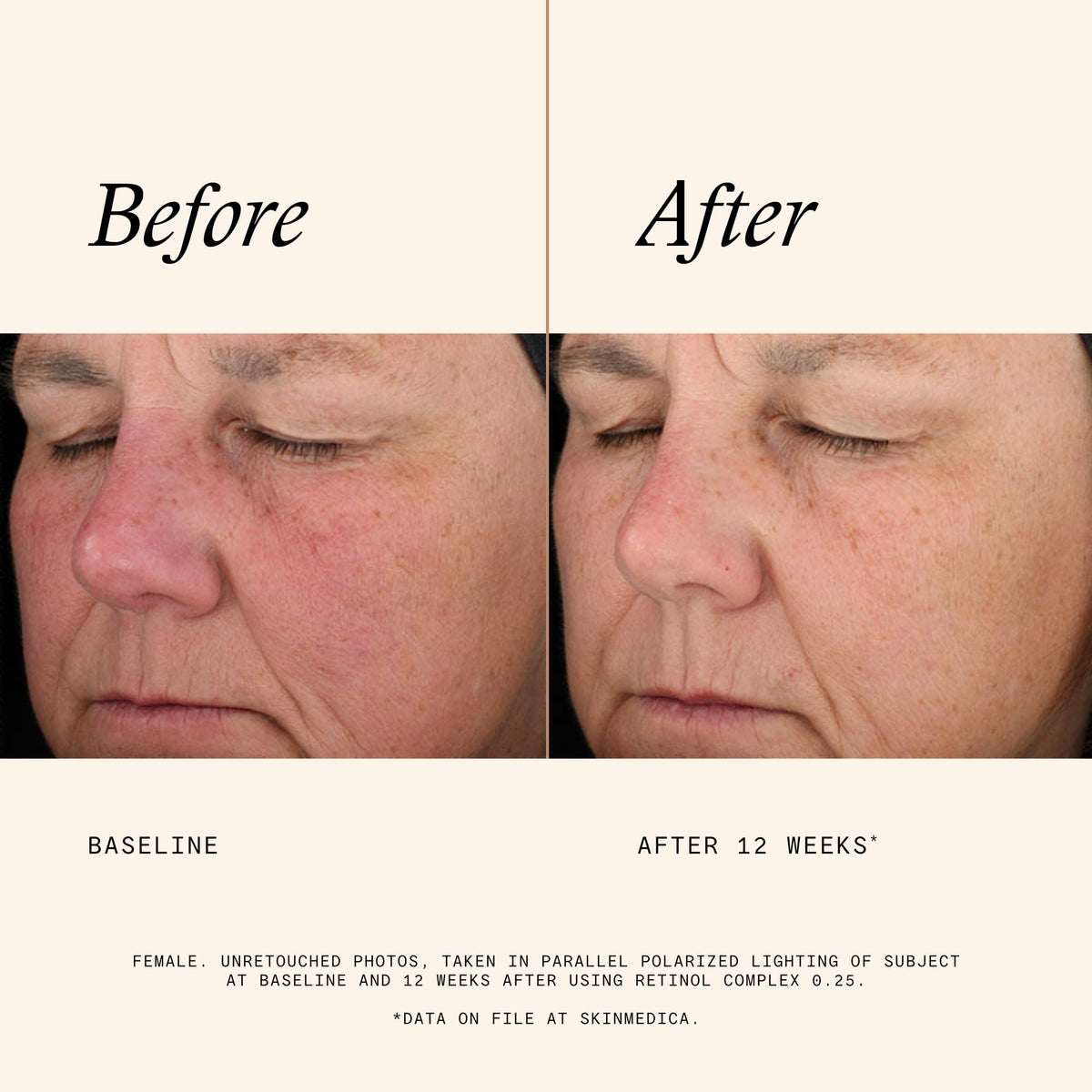 SkinMedica bottle held in hand to show size and travel-friendly benefit