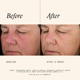 SkinMedica bottle held in hand to show size and travel-friendly benefit