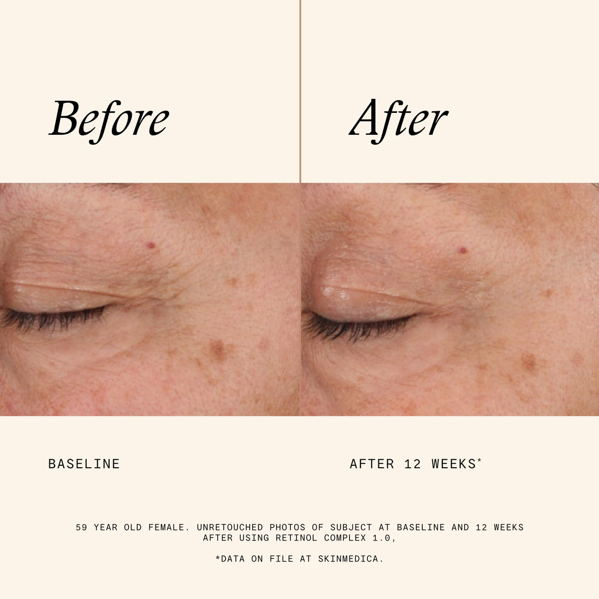 SkinMedica bottle beside box label, presents clear product identity and instructions