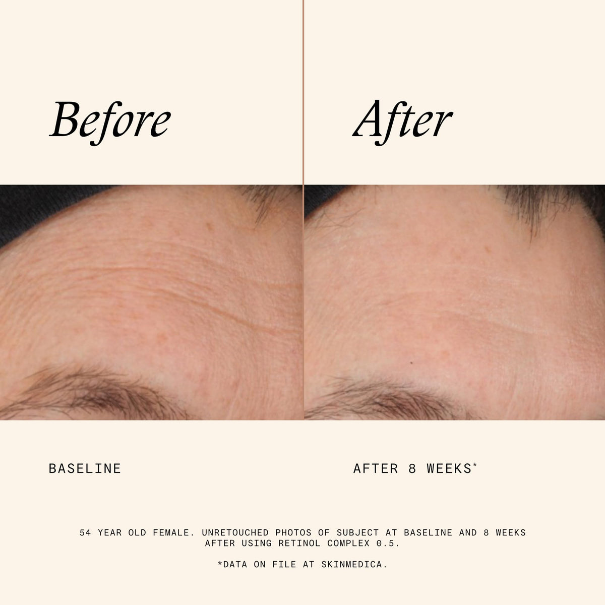 SkinMedica ingredient focus with niacinamide for even tone benefit