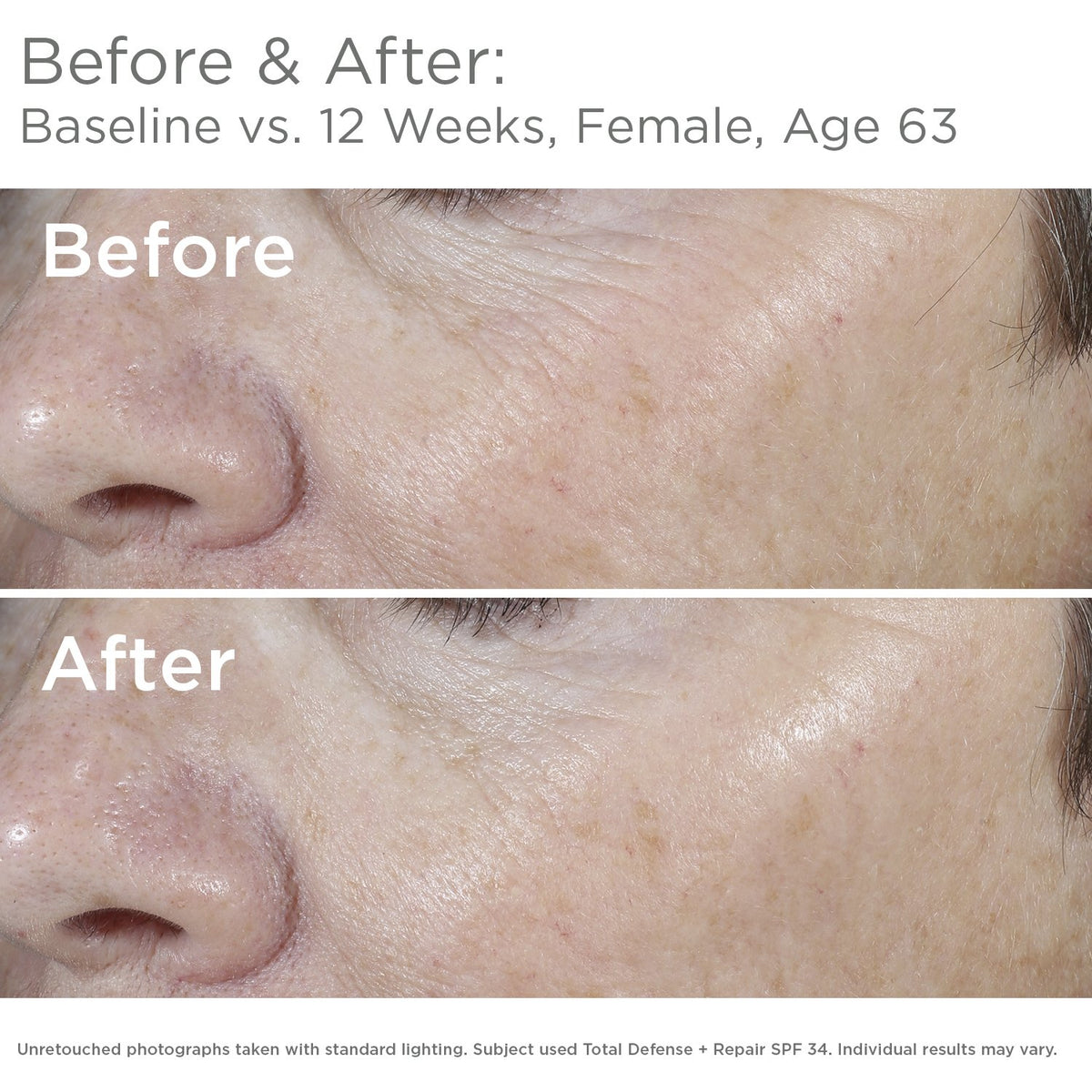 SkinMedica texture close-up showing lightweight blend and smooth finish
