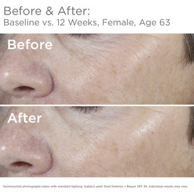 SkinMedica texture close-up showing lightweight blend and smooth finish