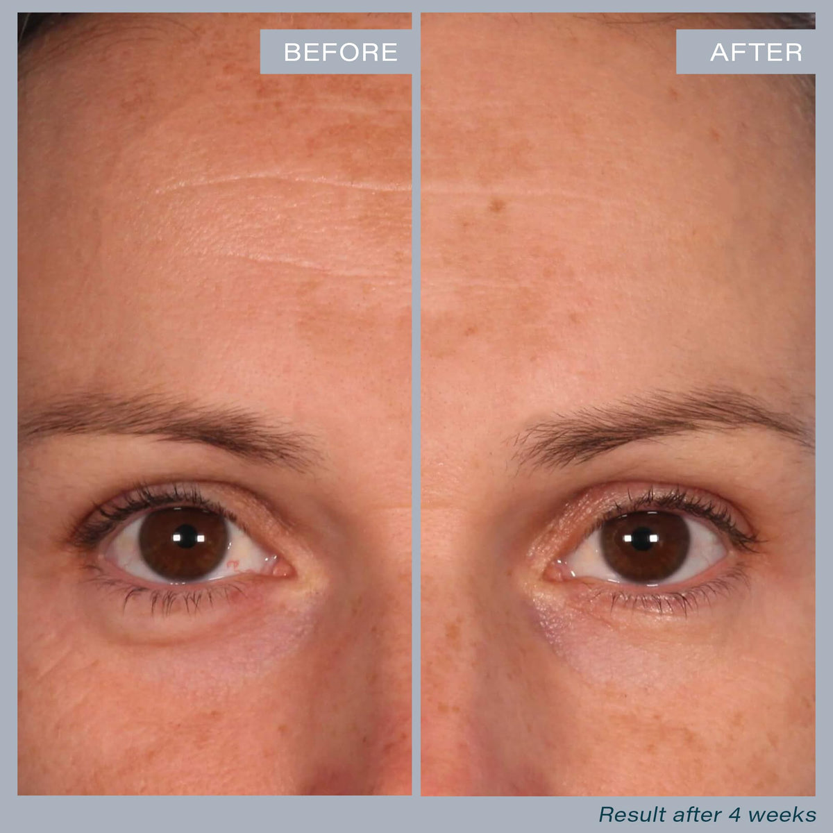 SKINN pad in hand demonstrating simple application and quick treatment