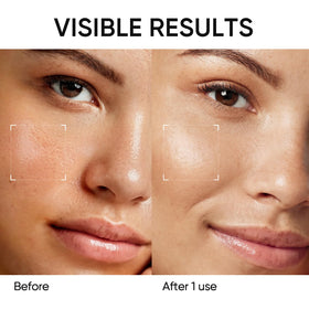 SKINTIFIC stick applied to t-zone showing targeted deep-cleaning benefit