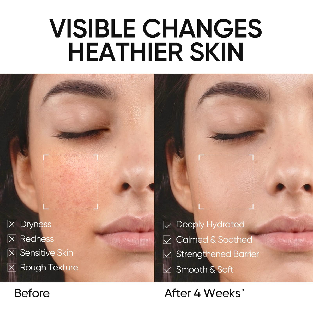 SKINTIFIC ingredient visual highlighting five ceramides and hydration