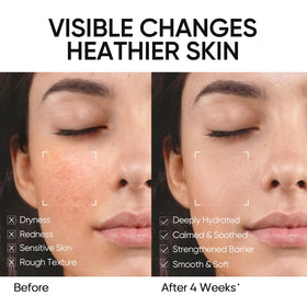 SKINTIFIC ingredient visual highlighting five ceramides and hydration