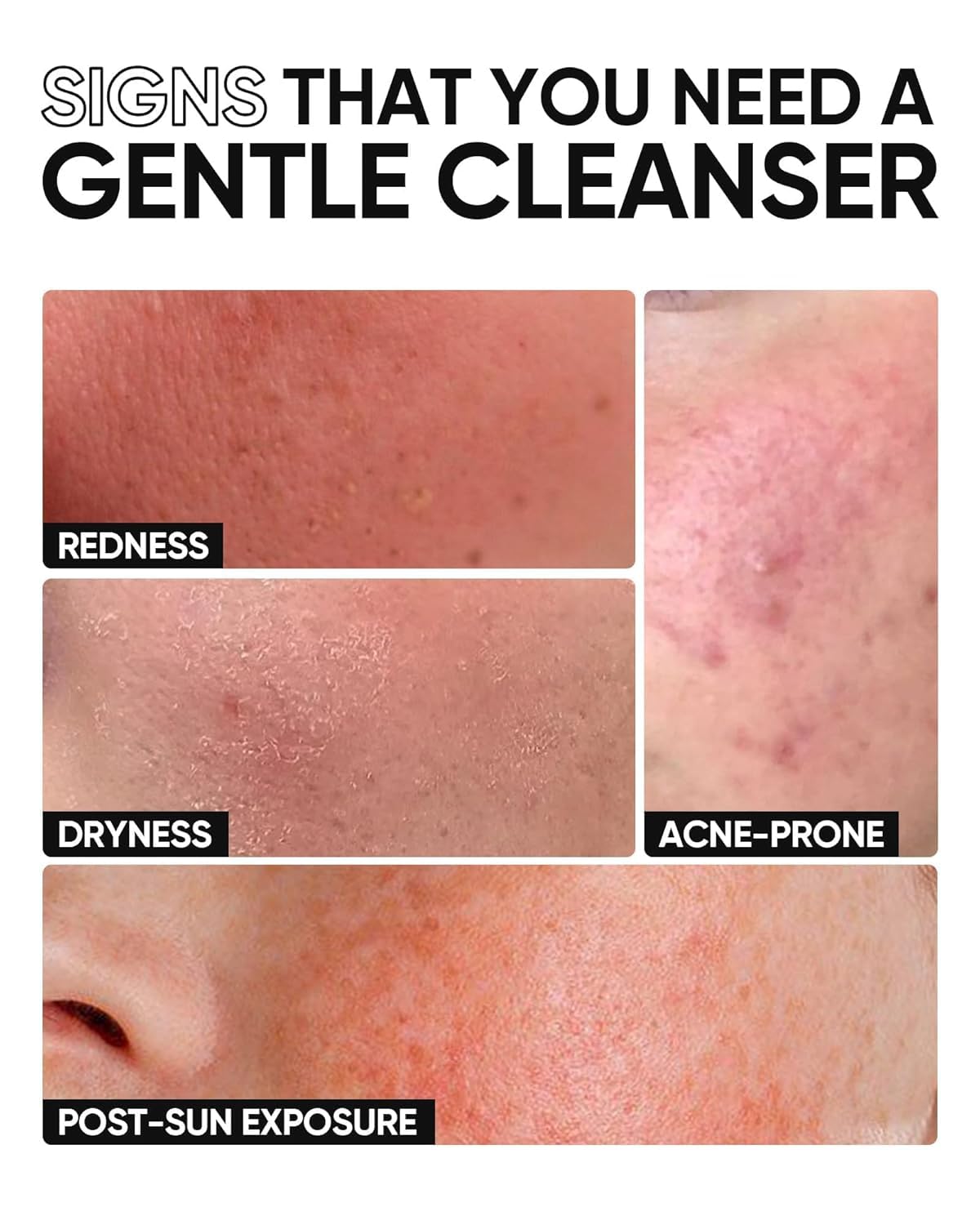 SKINTIFIC being applied to wet face demonstrating mild, effective cleanse