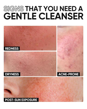 SKINTIFIC being applied to wet face demonstrating mild, effective cleanse