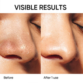SKINTIFIC mask applied on T-zone showing targeted pore coverage benefit