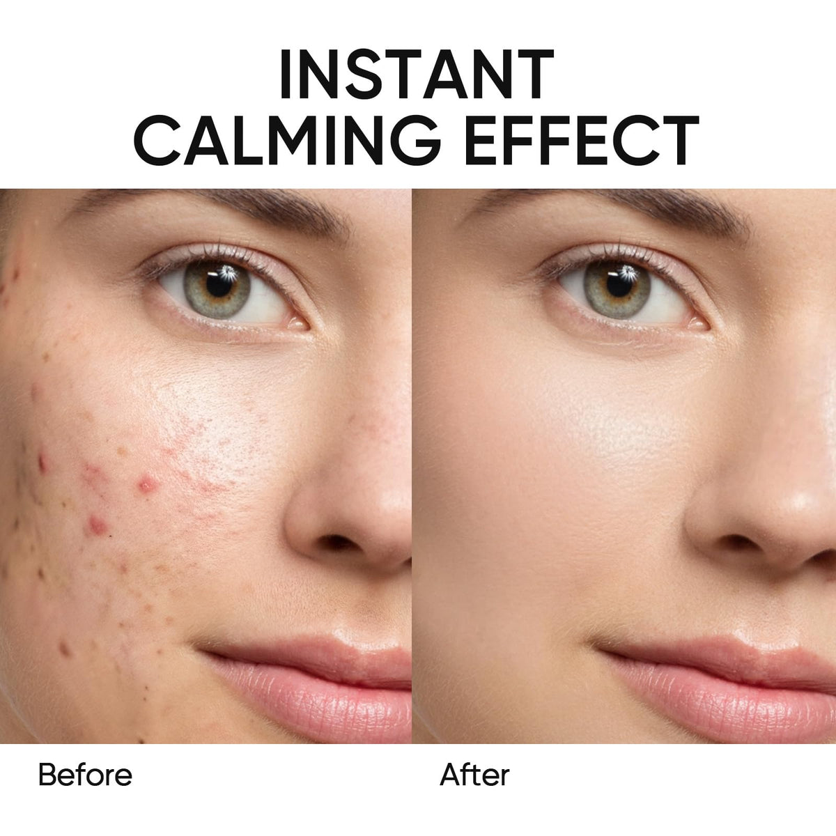 SKINTIFIC stick on forehead T-zone, helps absorb excess oil